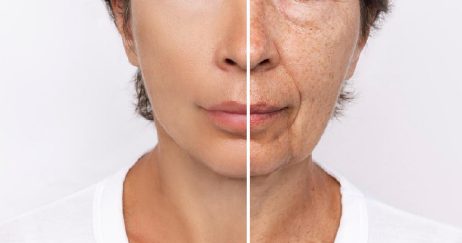 Anti-Aging Treatment In Bangalore